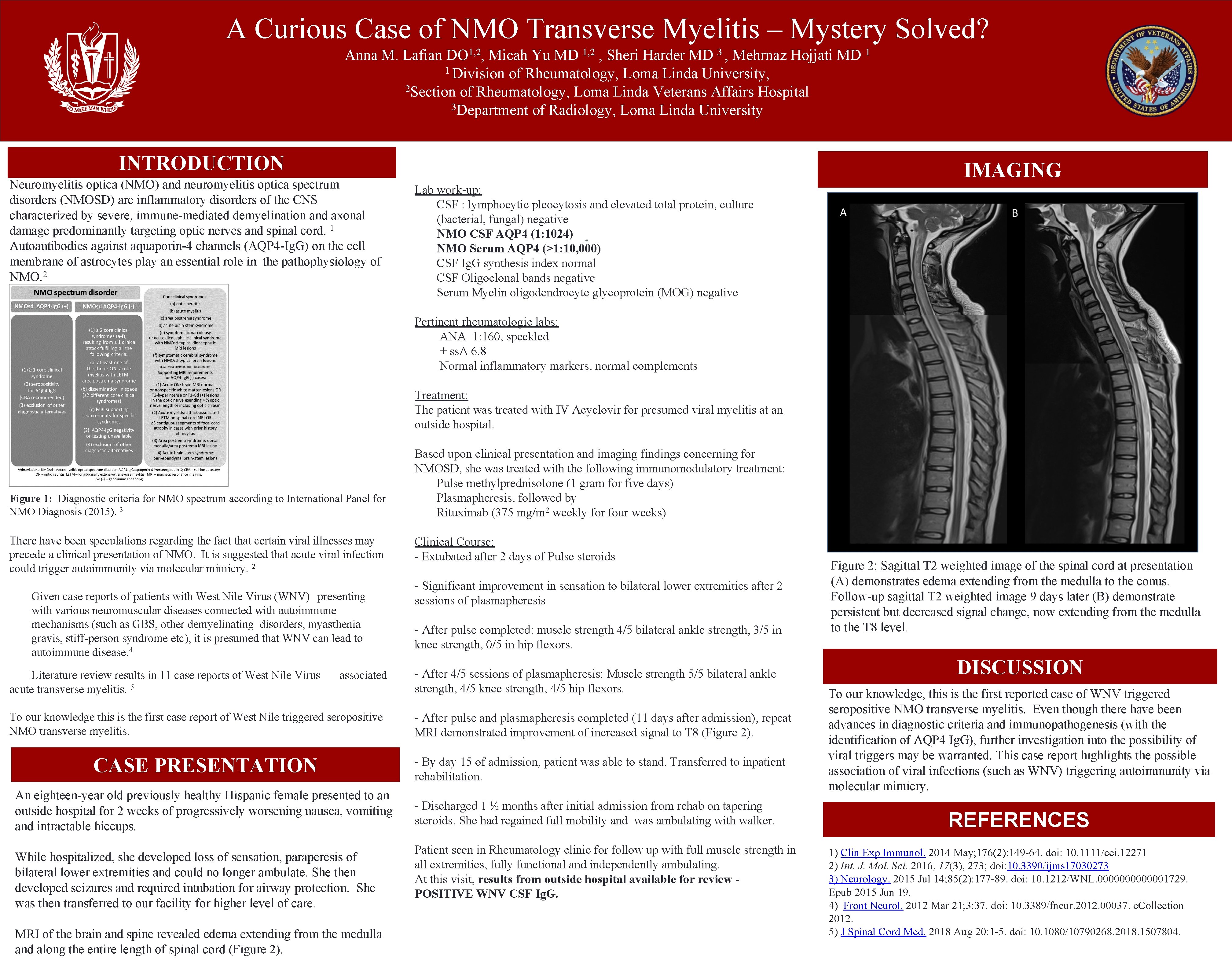 A Curious Case of NMO Transverse Myelitis – Mystery Solved? Anna M. Lafian DO