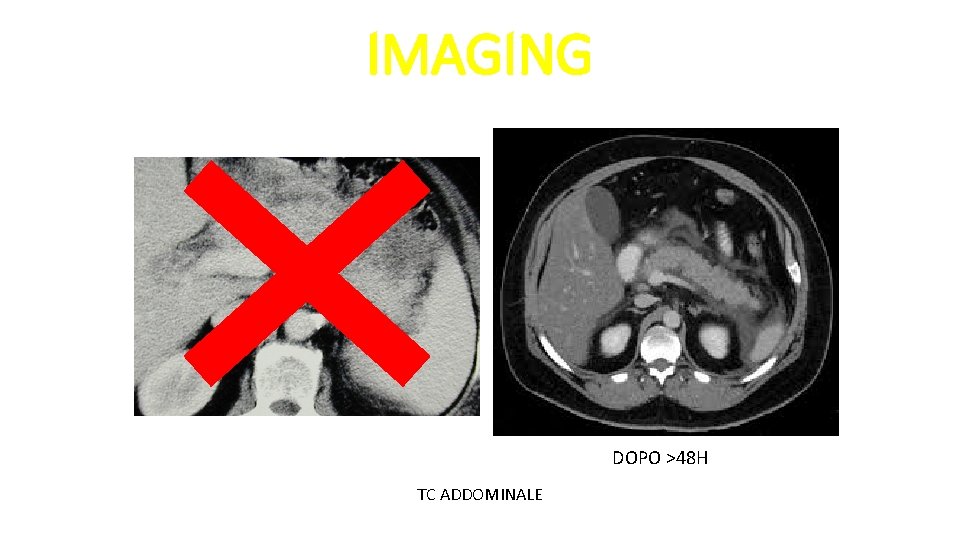 IMAGING DOPO >48 H TC ADDOMINALE 