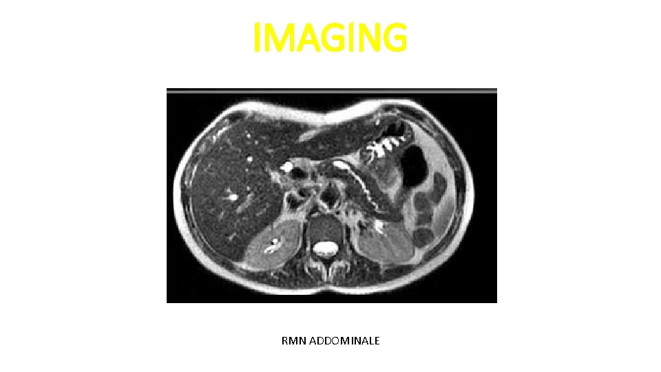 IMAGING RMN ADDOMINALE 