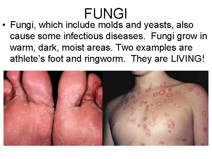 FUNGI • Fungi, which include molds and yeasts, also cause some infectious diseases. Fungi