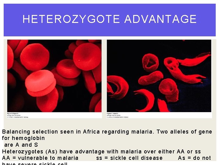 HETEROZYGOTE ADVANTAGE Balancing selection seen in Africa regarding malaria. Two alleles of gene for