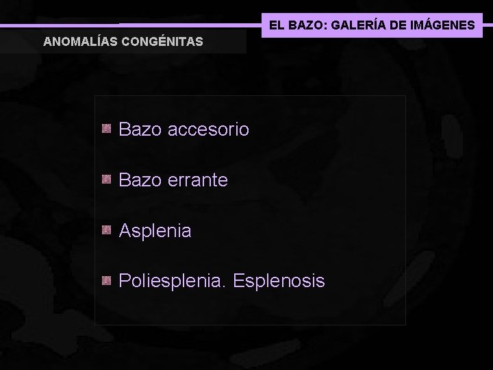 EL BAZO: GALERÍA DE IMÁGENES ANOMALÍAS CONGÉNITAS Bazo accesorio Bazo errante Asplenia Poliesplenia. Esplenosis