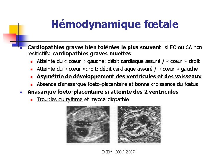 Hémodynamique fœtale n n Cardiopathies graves bien tolérées le plus souvent si FO ou