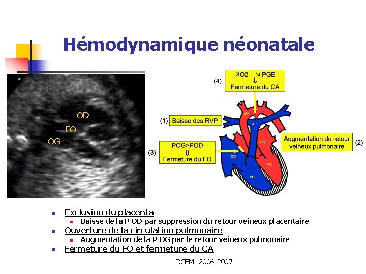 Hémodynamique néonatale OD FO OG n Exclusion du placenta n n Ouverture de la