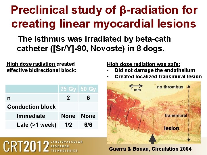 Preclinical study of β-radiation for creating linear myocardial lesions The isthmus was irradiated by