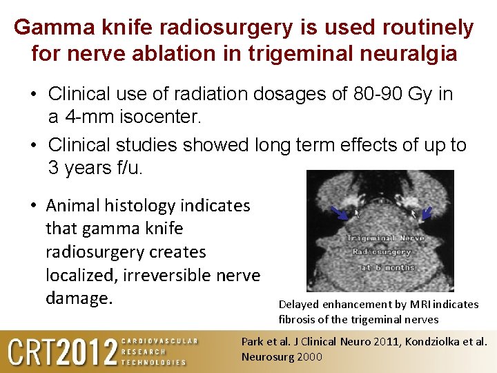 Gamma knife radiosurgery is used routinely for nerve ablation in trigeminal neuralgia • Clinical