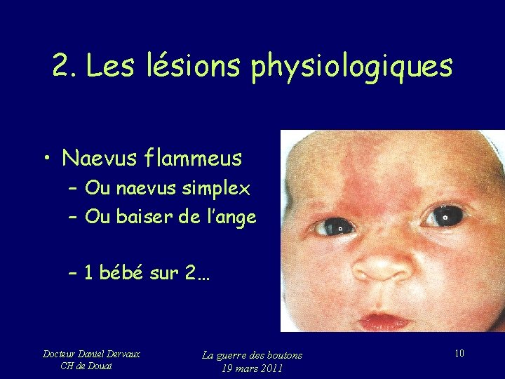 Les Maladies Boutons Ou Docteur Daniel Dervaux Ch Les Maladies Boutons Ou Docteur Daniel Dervaux Ch