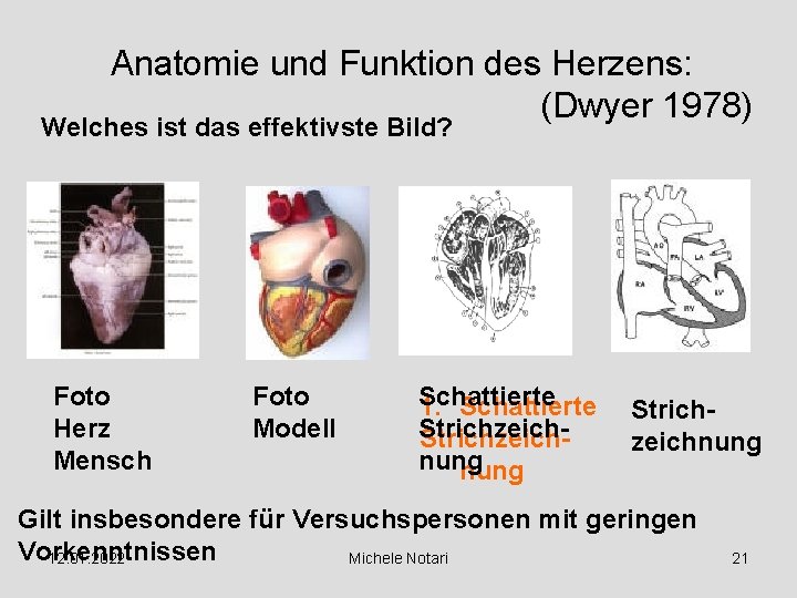 Anatomie und Funktion des Herzens: (Dwyer 1978) Welches ist das effektivste Bild? Foto Herz