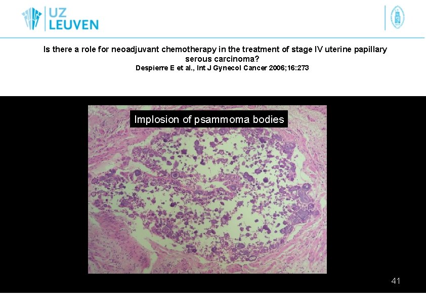 Is there a role for neoadjuvant chemotherapy in the treatment of stage IV uterine