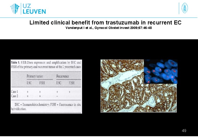 Limited clinical benefit from trastuzumab in recurrent EC Vandenput I et al. , Gynecol