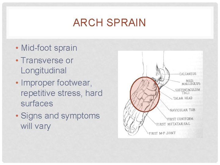 ARCH SPRAIN • Mid-foot sprain • Transverse or Longitudinal • Improper footwear, repetitive stress,