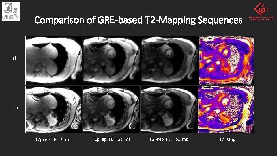 Comparison of GRE-based T 2 -Mapping Sequences Fl Tfi T 2 prep TE =