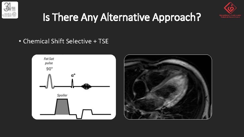 Is There Any Alternative Approach? • Chemical Shift Selective + TSE 