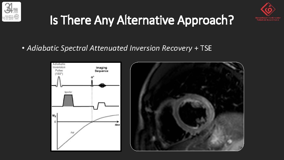 Is There Any Alternative Approach? • Adiabatic Spectral Attenuated Inversion Recovery + TSE 