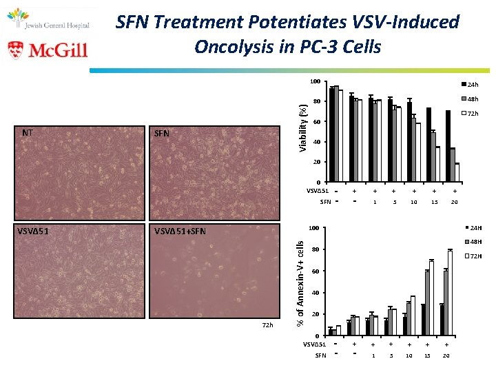 NT Viability (%) SFN Treatment Potentiates VSV-Induced Oncolysis in PC-3 Cells SFN 100 24