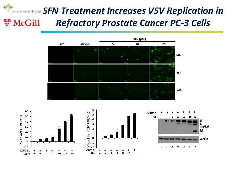 SFN Treatment Increases VSV Replication in Refractory Prostate Cancer PC-3 Cells SFN (μM) 5