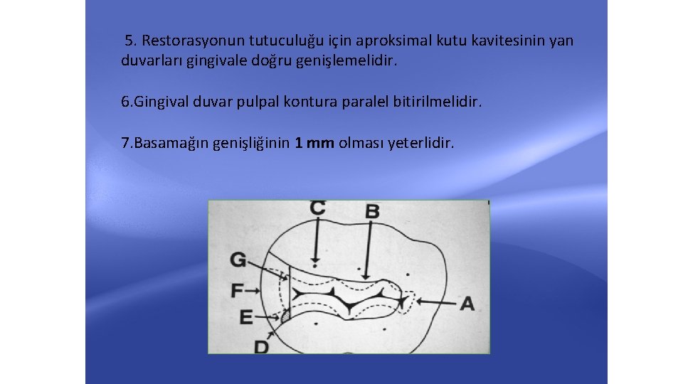 5. Restorasyonun tutuculuğu için aproksimal kutu kavitesinin yan duvarları gingivale doğru genişlemelidir. 6. Gingival 5. Restorasyonun tutuculuğu için aproksimal kutu kavitesinin yan duvarları gingivale doğru genişlemelidir. 6. Gingival