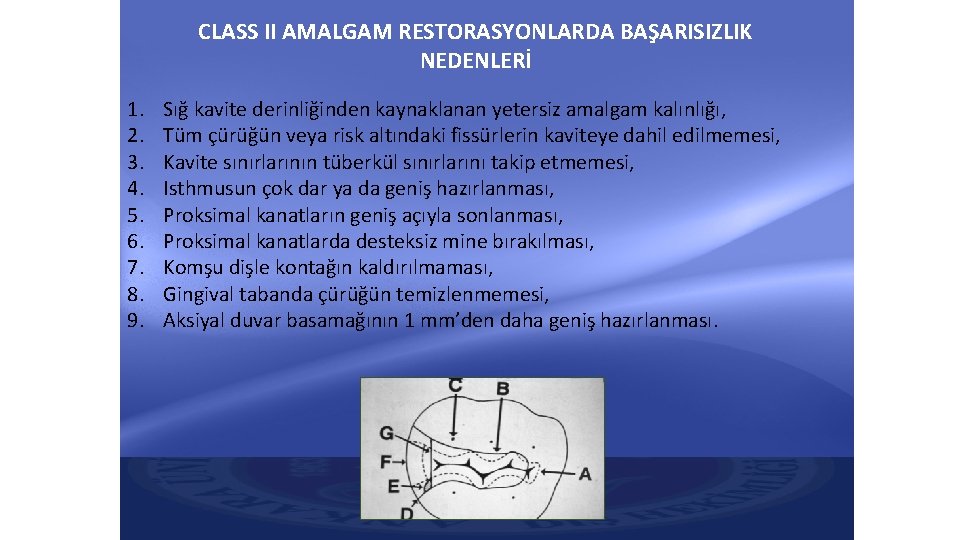 CLASS II AMALGAM RESTORASYONLARDA BAŞARISIZLIK NEDENLERİ 1. 2. 3. 4. 5. 6. 7. 8. CLASS II AMALGAM RESTORASYONLARDA BAŞARISIZLIK NEDENLERİ 1. 2. 3. 4. 5. 6. 7. 8.
