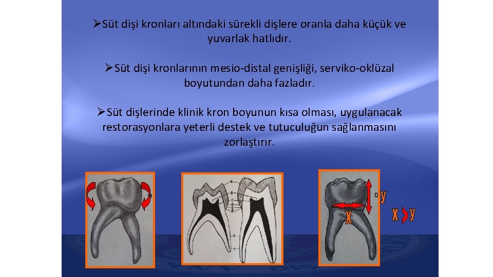 ØSüt dişi kronları altındaki sürekli dişlere oranla daha küçük ve yuvarlak hatlıdır. ØSüt dişi ØSüt dişi kronları altındaki sürekli dişlere oranla daha küçük ve yuvarlak hatlıdır. ØSüt dişi