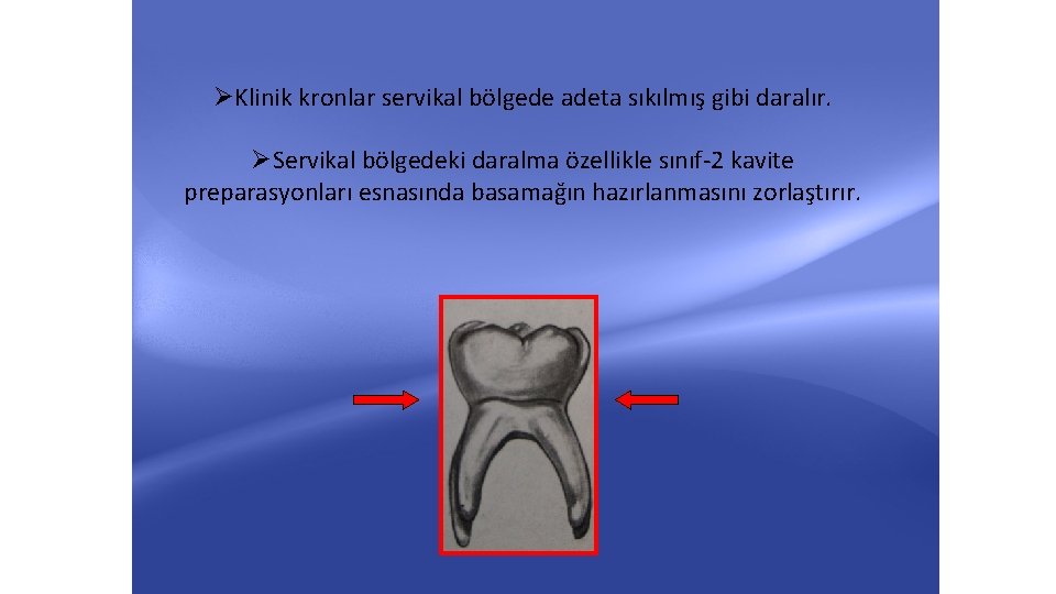 ØKlinik kronlar servikal bölgede adeta sıkılmış gibi daralır. ØServikal bölgedeki daralma özellikle sınıf-2 kavite ØKlinik kronlar servikal bölgede adeta sıkılmış gibi daralır. ØServikal bölgedeki daralma özellikle sınıf-2 kavite