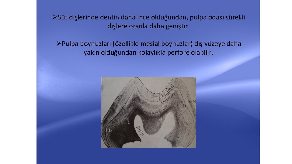 ØSüt dişlerinde dentin daha ince olduğundan, pulpa odası sürekli dişlere oranla daha geniştir. ØPulpa ØSüt dişlerinde dentin daha ince olduğundan, pulpa odası sürekli dişlere oranla daha geniştir. ØPulpa