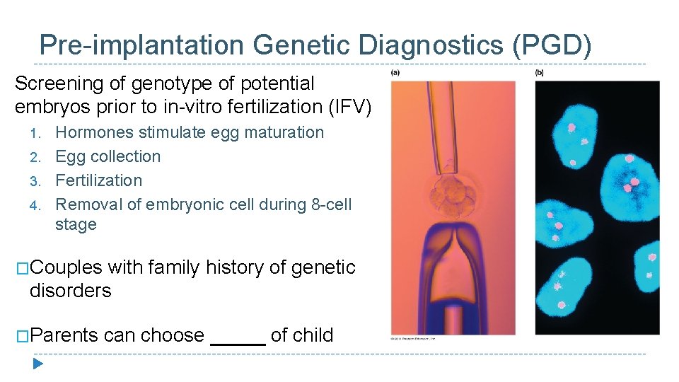 Pre-implantation Genetic Diagnostics (PGD) Screening of genotype of potential embryos prior to in-vitro fertilization