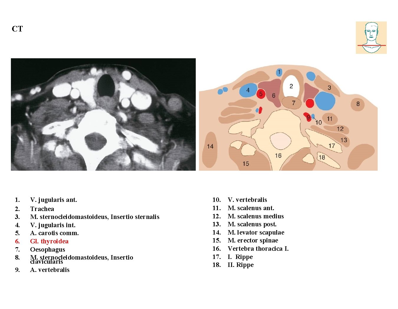 CT 1. 2. 3. 4. 5. 6. 7. 8. 9. V. jugularis ant. Trachea CT 1. 2. 3. 4. 5. 6. 7. 8. 9. V. jugularis ant. Trachea
