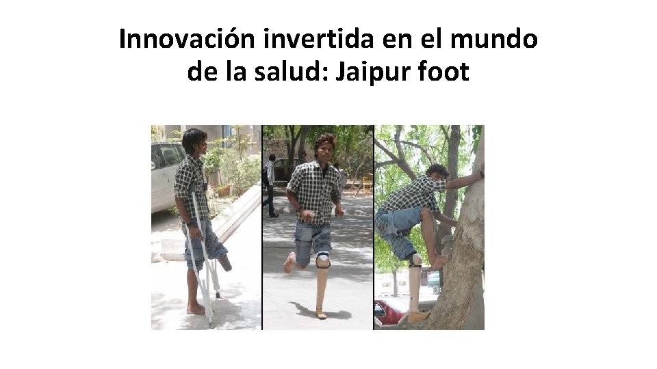 Innovación invertida en el mundo de la salud: Jaipur foot 