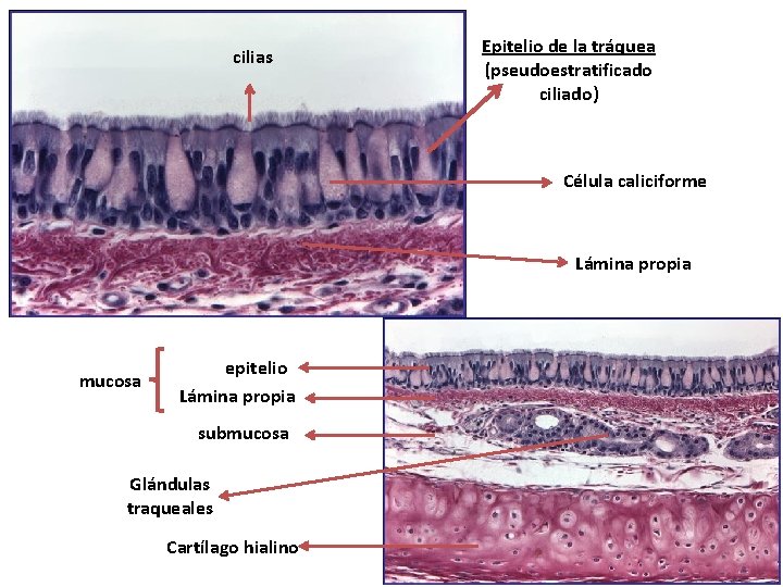 cilias Epitelio de la tráquea (pseudoestratificado ciliado) Célula caliciforme Lámina propia mucosa epitelio Lámina