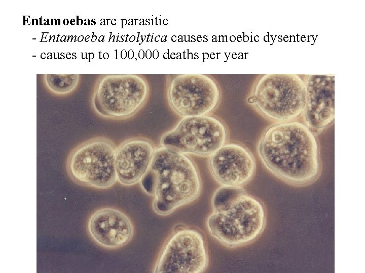 Entamoebas are parasitic - Entamoeba histolytica causes amoebic dysentery - causes up to 100, Entamoebas are parasitic - Entamoeba histolytica causes amoebic dysentery - causes up to 100,