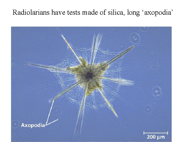 Radiolarians have tests made of silica, long ‘axopodia’ Radiolarians have tests made of silica, long ‘axopodia’