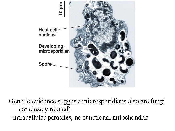 Genetic evidence suggests microsporidians also are fungi (or closely related) - intracellular parasites, no Genetic evidence suggests microsporidians also are fungi (or closely related) - intracellular parasites, no