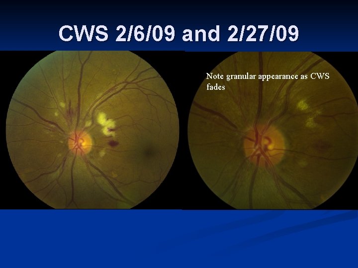 CWS 2/6/09 and 2/27/09 Note granular appearance as CWS fades 