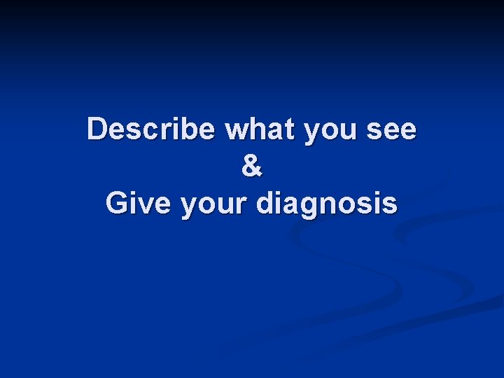 Describe what you see & Give your diagnosis 