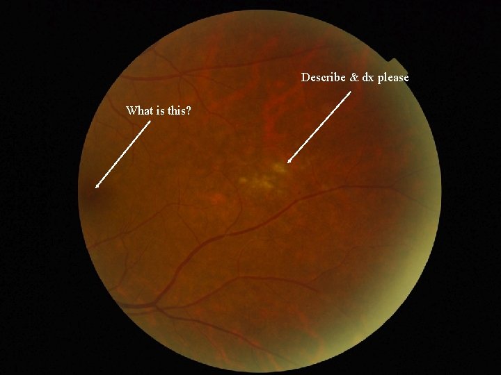 Describe & dx please What is this? 