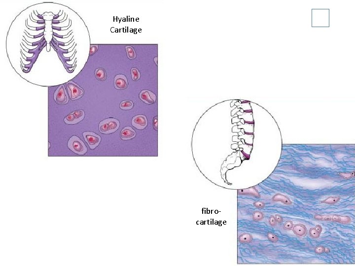 Hyaline Cartilage fibrocartilage 