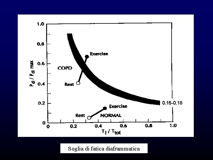 0. 15 -0. 18 Soglia di fatica diaframmatica 0. 15 -0. 18 Soglia di fatica diaframmatica