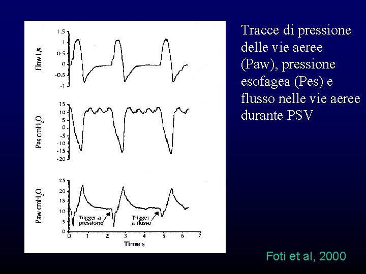 Tracce di pressione delle vie aeree (Paw), pressione esofagea (Pes) e flusso nelle vie Tracce di pressione delle vie aeree (Paw), pressione esofagea (Pes) e flusso nelle vie