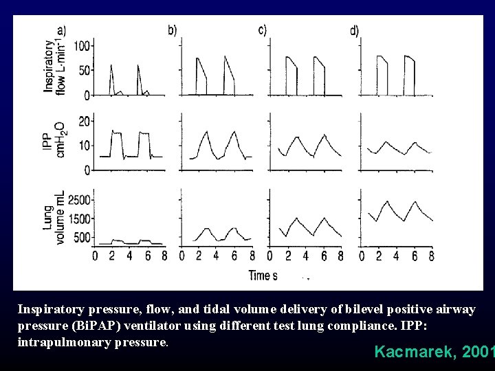 Inspiratory pressure, flow, and tidal volume delivery of bilevel positive airway pressure (Bi. PAP) Inspiratory pressure, flow, and tidal volume delivery of bilevel positive airway pressure (Bi. PAP)