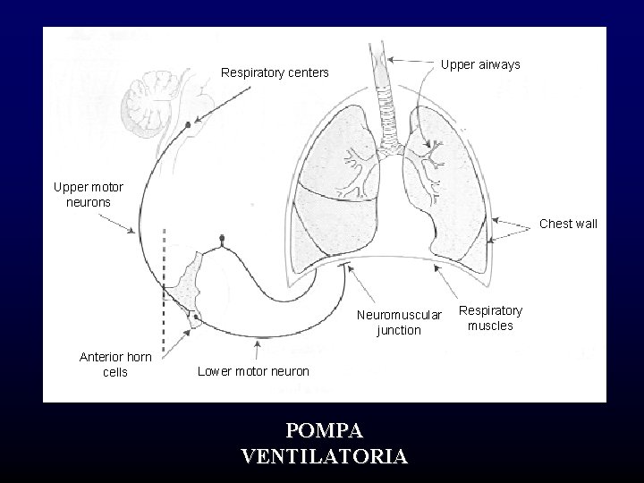 Upper airways Respiratory centers Upper motor neurons Chest wall Neuromuscular junction Anterior horn cells Upper airways Respiratory centers Upper motor neurons Chest wall Neuromuscular junction Anterior horn cells