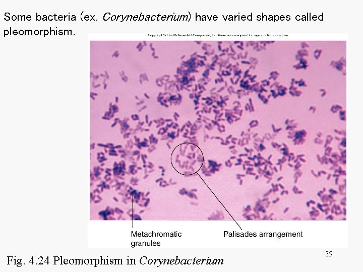 Some bacteria (ex. Corynebacterium) have varied shapes called pleomorphism. Fig. 4. 24 Pleomorphism in Some bacteria (ex. Corynebacterium) have varied shapes called pleomorphism. Fig. 4. 24 Pleomorphism in