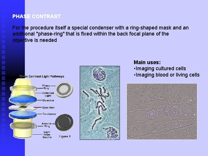 PHASE CONTRAST For the procedure itself a special condenser with a ring-shaped mask and