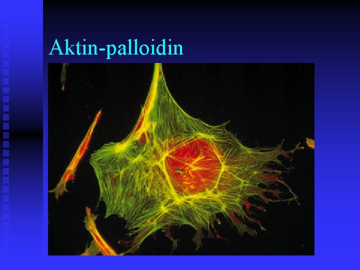 Aktin-palloidin 