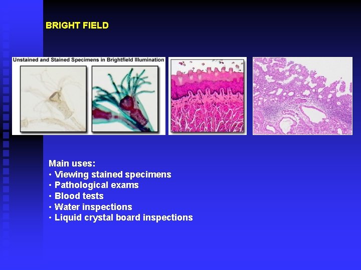BRIGHT FIELD Main uses: • Viewing stained specimens • Pathological exams • Blood tests
