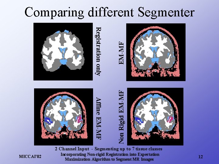 Registration only EM-MF Affine EM-MF Non Rigid EM-MF Comparing different Segmenter 2 Channel Input