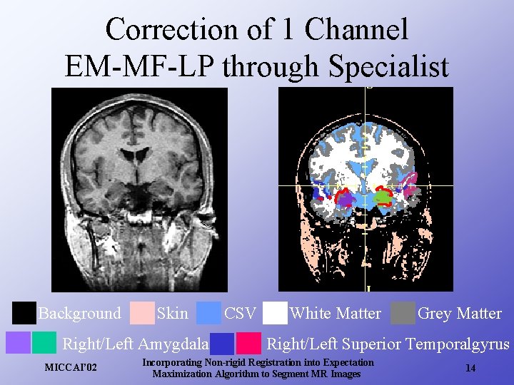 Correction of 1 Channel EM-MF-LP through Specialist Background Skin Right/Left Amygdala MICCAI’ 02 CSV