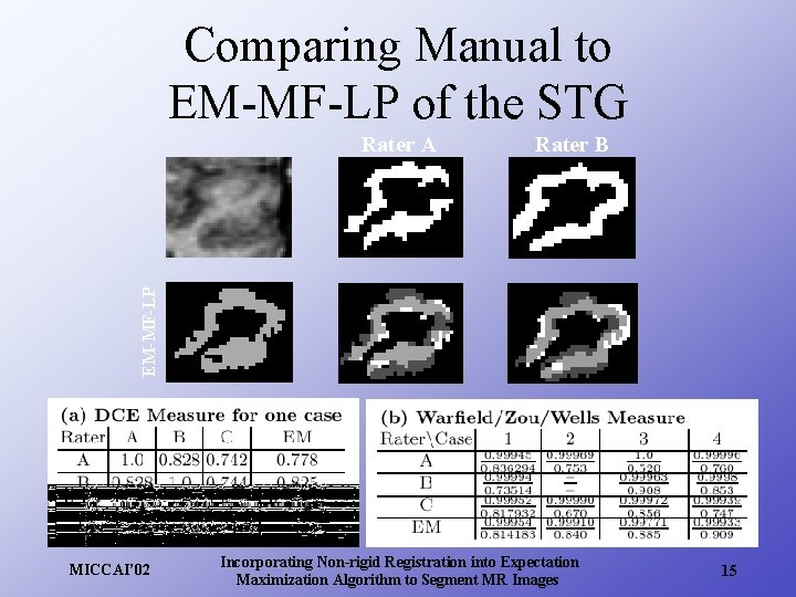 Comparing Manual to EM-MF-LP of the STG Rater B EM-MF-LP Rater A MICCAI’ 02