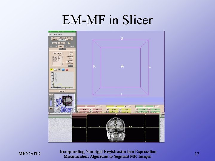 EM-MF in Slicer MICCAI’ 02 Incorporating Non-rigid Registration into Expectation Maximization Algorithm to Segment