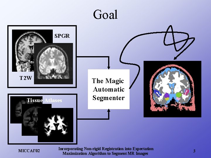 Goal SPGR T 2 W Tissue Atlases MICCAI’ 02 The Magic Automatic Segmenter Incorporating