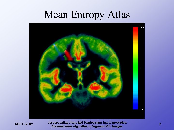 Mean Entropy Atlas MICCAI’ 02 Incorporating Non-rigid Registration into Expectation Maximization Algorithm to Segment